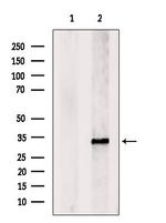 V-ATPase E1 Antibody in Western Blot (WB)