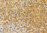 CPOX Antibody in Immunohistochemistry (Paraffin) (IHC (P))