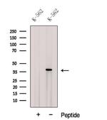 CPOX Antibody in Western Blot (WB)