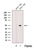 DMKN Antibody in Western Blot (WB)