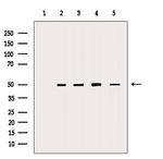 DMKN Antibody in Western Blot (WB)