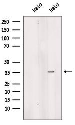 EXOSC8 Antibody in Western Blot (WB)