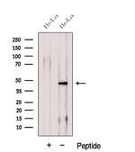 Folliculin Antibody in Western Blot (WB)