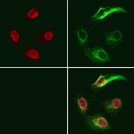 GNAQ Antibody in Immunocytochemistry (ICC/IF)