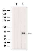 GSTZ1 Antibody in Western Blot (WB)