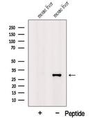 GSTZ1 Antibody in Western Blot (WB)