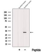 ICMT Antibody in Western Blot (WB)