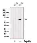 ISYNA1 Antibody in Western Blot (WB)