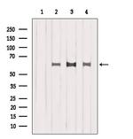 ISYNA1 Antibody in Western Blot (WB)