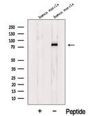 LDB3 Antibody in Western Blot (WB)