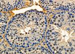 MED12 Antibody in Immunohistochemistry (Paraffin) (IHC (P))