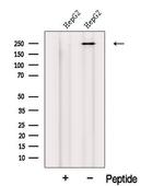 MED12 Antibody in Western Blot (WB)