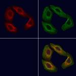 POMGNT1 Antibody in Immunocytochemistry (ICC/IF)