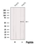 POMGNT1 Antibody in Western Blot (WB)