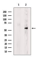 POMGNT1 Antibody in Western Blot (WB)