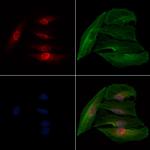 NHP2 Antibody in Immunocytochemistry (ICC/IF)