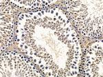 NHP2 Antibody in Immunohistochemistry (Paraffin) (IHC (P))