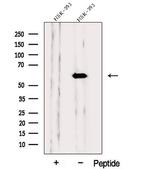 PPP3CB Antibody in Western Blot (WB)