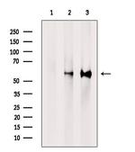 PPP3CB Antibody in Western Blot (WB)