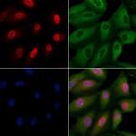 PRUNE2 Antibody in Immunocytochemistry (ICC/IF)