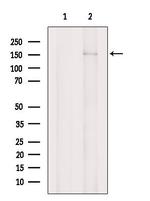 PRUNE2 Antibody in Western Blot (WB)