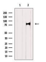 RNF12 Antibody in Western Blot (WB)