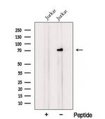 RNF12 Antibody in Western Blot (WB)