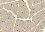 RNaseH2C Antibody in Immunohistochemistry (Paraffin) (IHC (P))