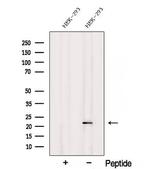 RNaseH2C Antibody in Western Blot (WB)