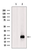 RNaseH2C Antibody in Western Blot (WB)