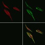 RPN1 Antibody in Immunocytochemistry (ICC/IF)