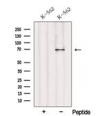 RPN1 Antibody in Western Blot (WB)