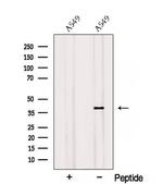 RSPO3 Antibody in Western Blot (WB)