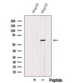 SESN3 Antibody in Western Blot (WB)