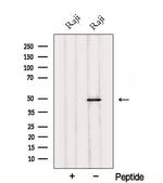 SAB Antibody in Western Blot (WB)