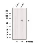 SLC38A1 Antibody in Western Blot (WB)