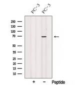 SPATA7 Antibody in Western Blot (WB)