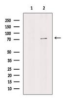 STRA6 Antibody in Western Blot (WB)