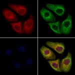 TBCE Antibody in Immunocytochemistry (ICC/IF)