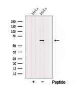 TBCE Antibody in Western Blot (WB)