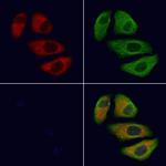 TRPC1 Antibody in Immunocytochemistry (ICC/IF)