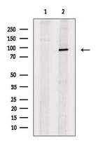 TRPC1 Antibody in Western Blot (WB)