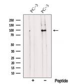 TRPC1 Antibody in Western Blot (WB)