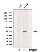 UCK2 Antibody in Western Blot (WB)