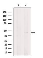 UCK2 Antibody in Western Blot (WB)