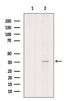 UCK2 Antibody in Western Blot (WB)