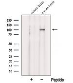 VPS39 Antibody in Western Blot (WB)