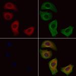 VPS41 Antibody in Immunocytochemistry (ICC/IF)