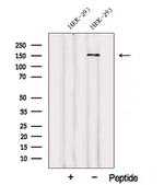 WDR19 Antibody in Western Blot (WB)