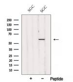 AJUBA Antibody in Western Blot (WB)